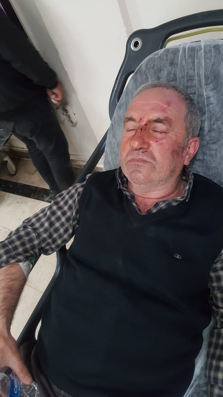 Antalya'da kulak zarını patlatana kadar dövdüler