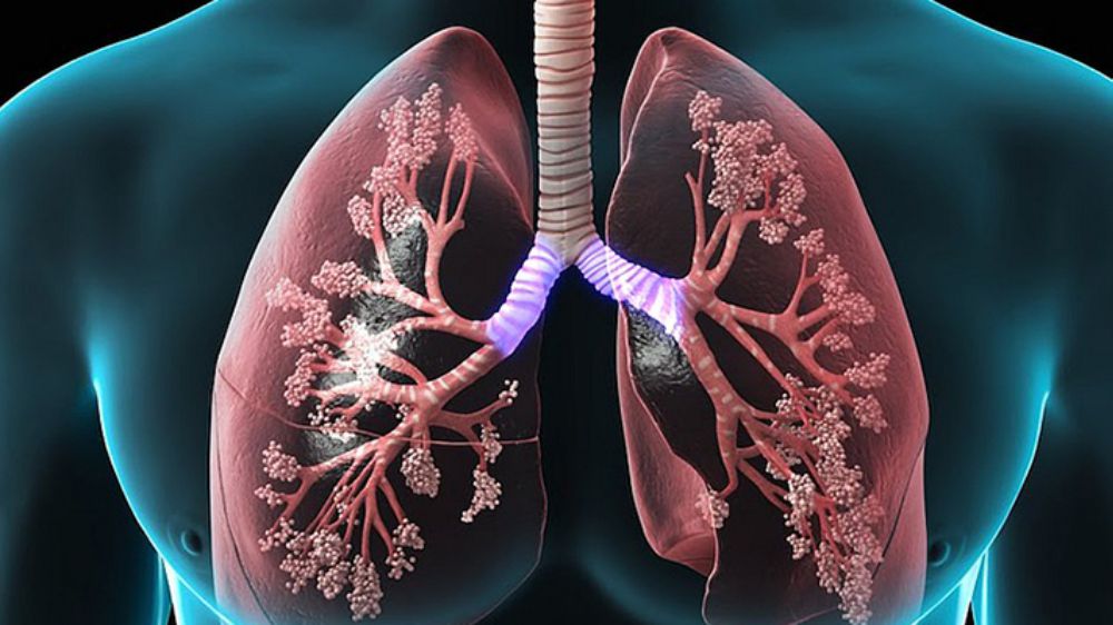 Akciğerler: Yapısı, görevleri ve hastalıkları KOAH ve Astım