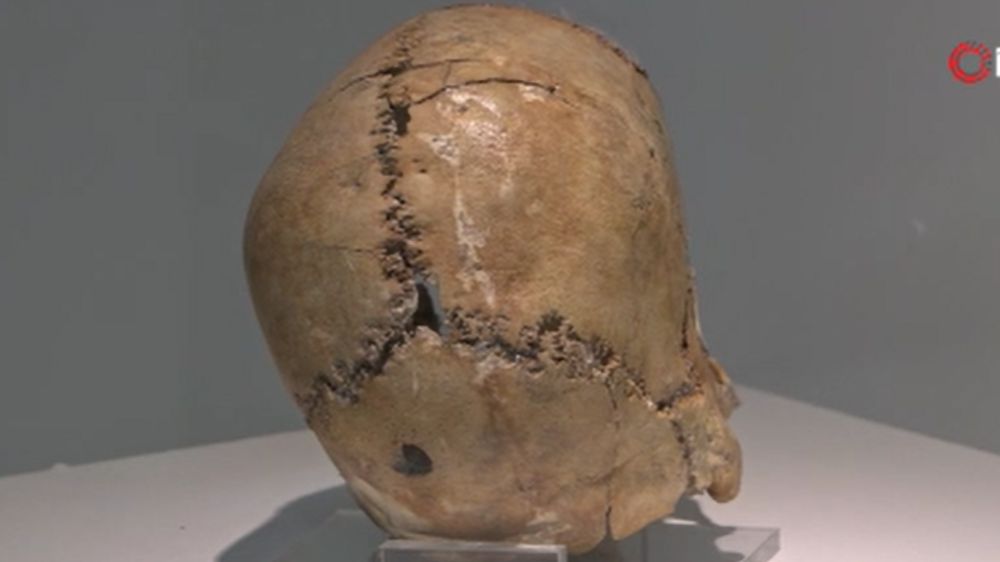 Aksaray'da 10 Bin 500 Yıl Önce İlk Beyin Ameliyatı: Şaşırtan Tarihi Keşif