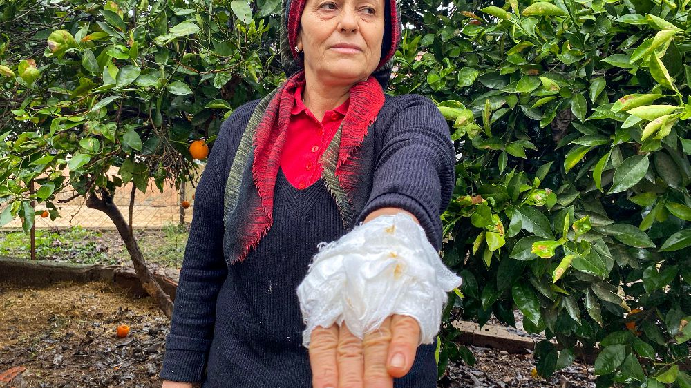 Antalya'da yumurta toplamak için bahçeye giren kadın, dobermanın saldırısına uğradı