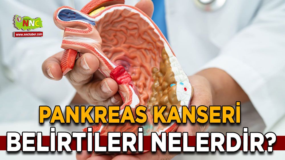 Pankreas Kanseri belirtileri nelerdir?