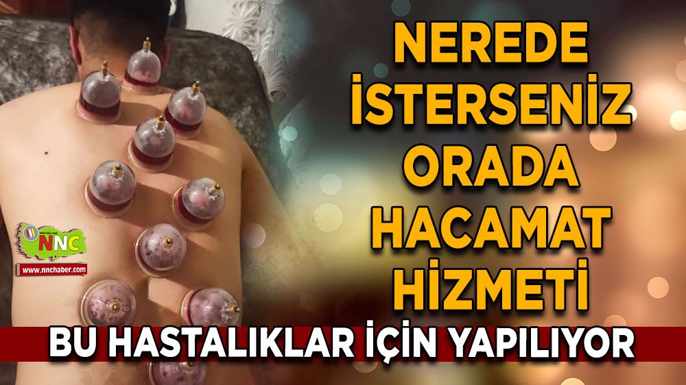 Siz neredeyseniz oraya geliyor! Bucak ve Antalya hacamat hizmeti