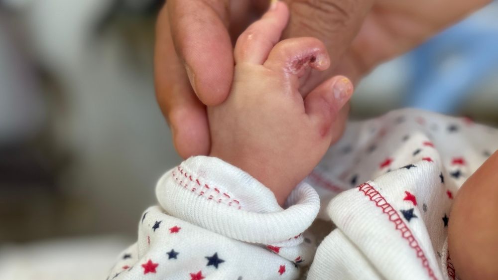 Diyarbakır Özel Bower Hastanesinde büyük iddia!  2 aylık prematüre bebekte sakatlık oluştu