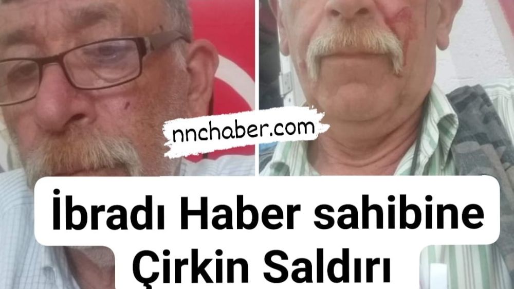 Antalya İbradı haber Yusuf Doğaroğlu Saldırıya Uğradı 