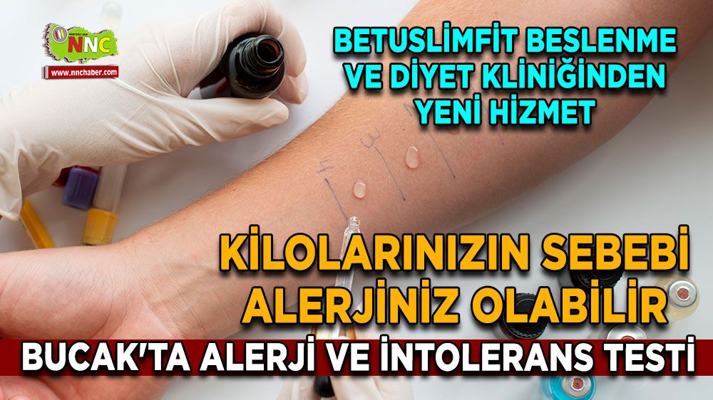 Kilolarınızın sebebi alerjiniz olabilir Bucak'ta alerji testi hizmeti kaçmaz