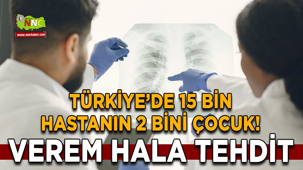 Verem hala tehdit Türkiye’de 15 bin hastanın 2 bini çocuk!