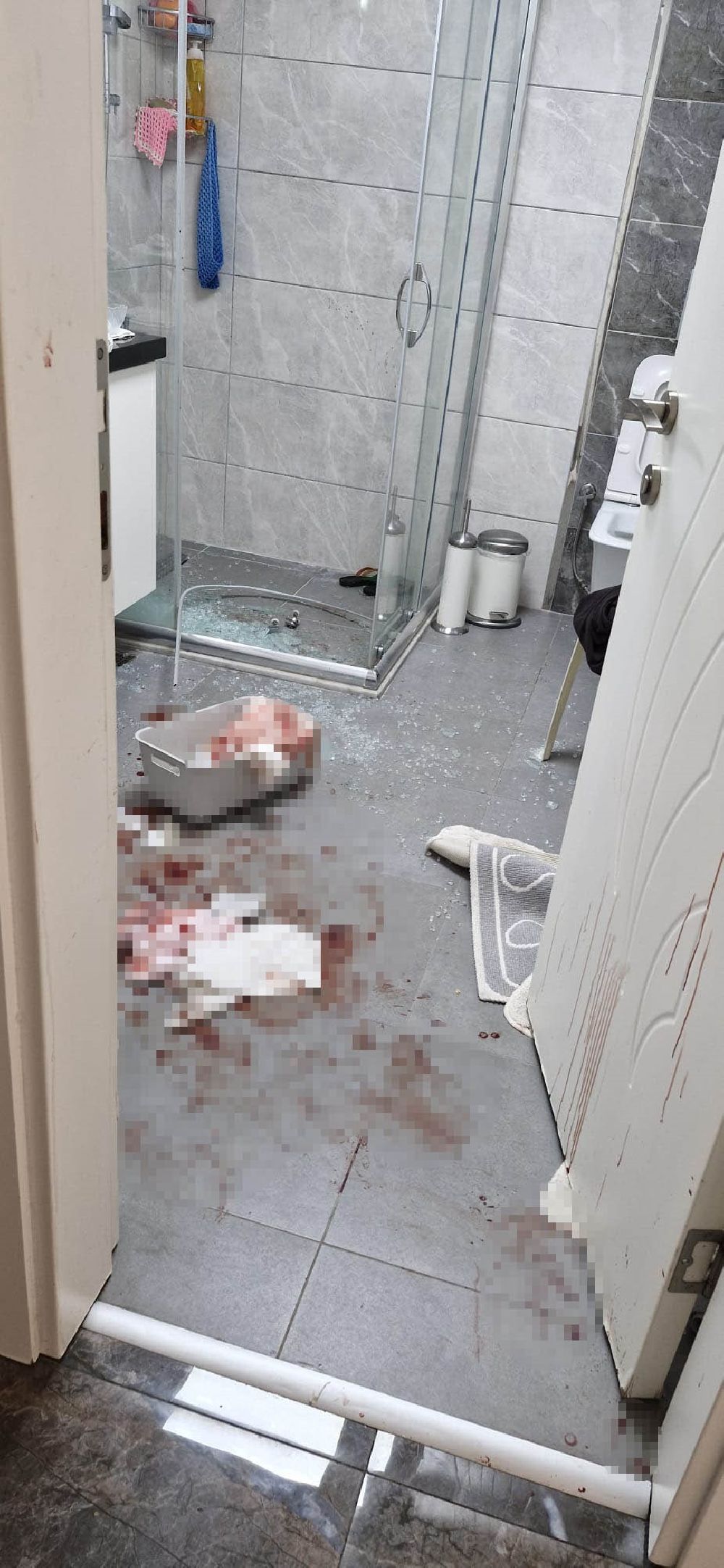 Antalya'da duşa kabin patladı, eline 20'ye yakın dikiş atıldı