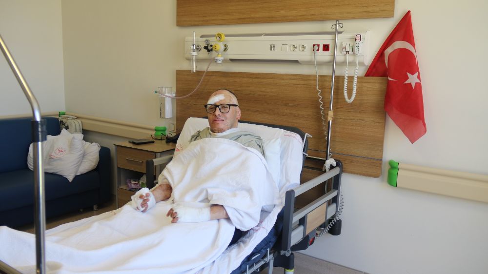 6 bin voltluk akıma kapılıp ölümden dönen Azerbaycanlı mühendis Eskişehir'de tedavi oldu