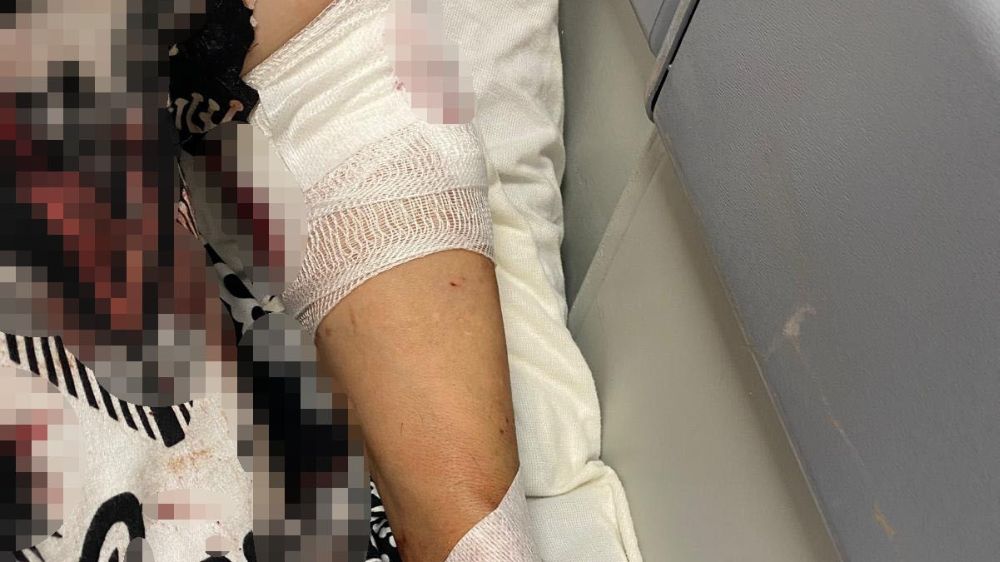Abdest almak için bahçeye çıkan kadına köpekler saldırdı