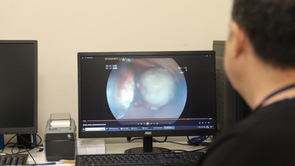 Dev mide tümörü cerrahi müdahaleye gerek kalmadan endoskopik yöntemle çıkarıldı