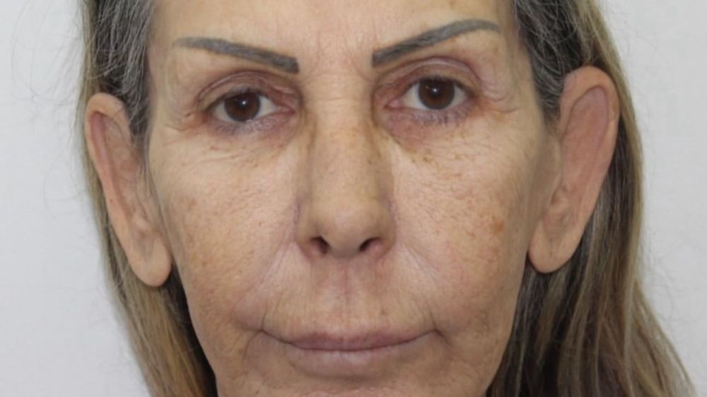 Petek Dinçöz'den sonra annesi de estetik ameliyat oldu: Son hali şaşırttı