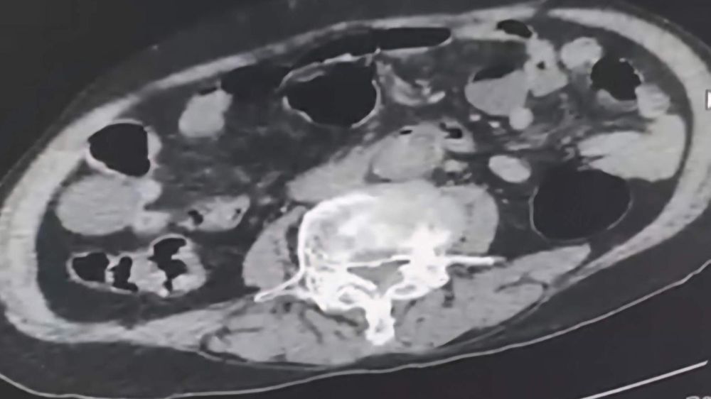 Cinsel organında Denizli’ye uyuşturucu sokmak isteyen yabancı uyruklu şahıs yakalandı