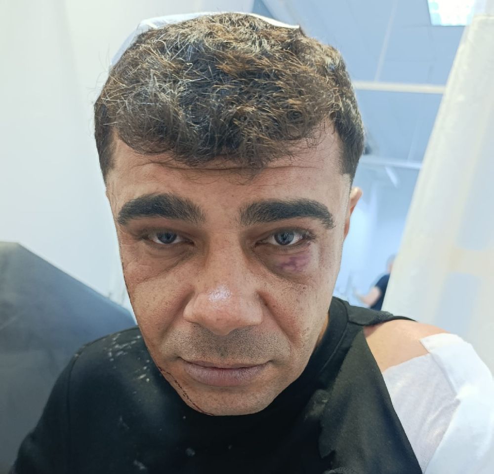 İş görüşmesi için gitti, ölümden döndü