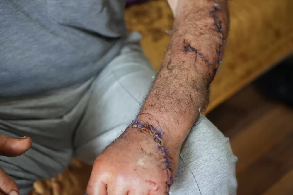 Kendisini bıçaklayıp uzaklaştırma alan eşini bankta yatarken görüp eve aldı, kendi evsiz kaldı