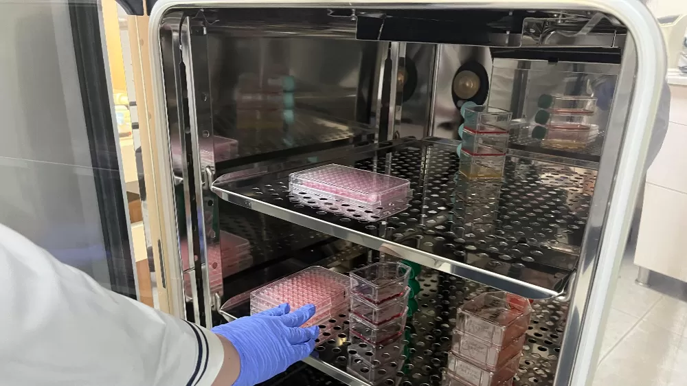 Parkinson’da bağırsak- beyin iletişimi çip üstü organ teknolojisiyle araştırılıyor