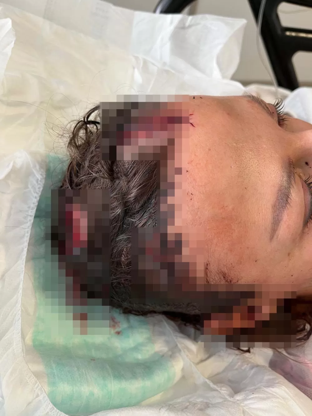 Antalya'da uzaklaştırma ihlaliyle sopalı saldırı davası! 20 yıllık cezalandırma talep etti