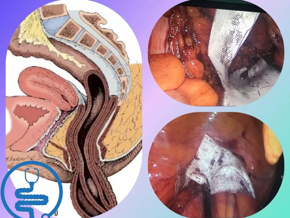 Antalya Elmalı Devlet Hastanesi'nde bir ilk