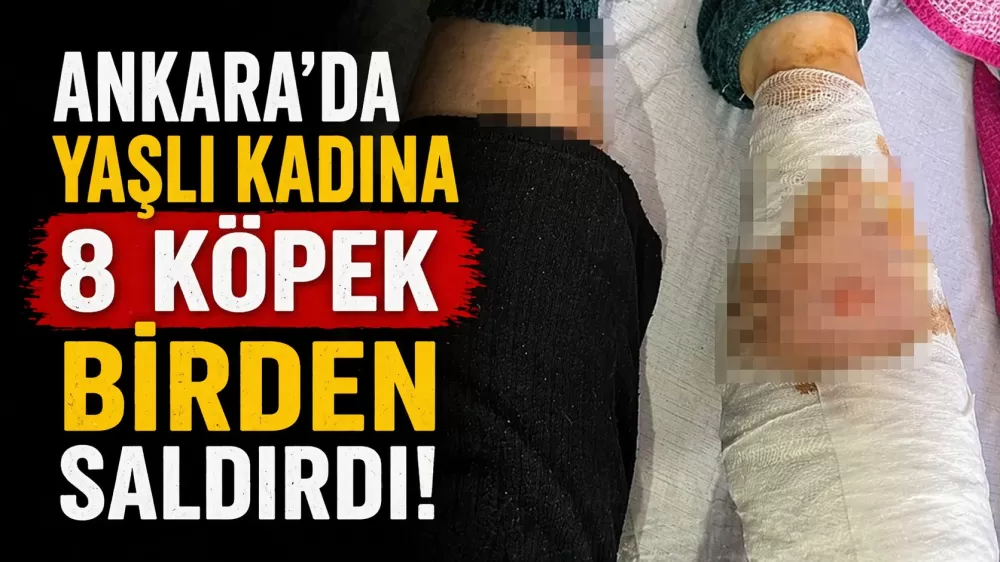 Ankara'da Yaşlı Kadına 8 Köpek Birden Saldırdı