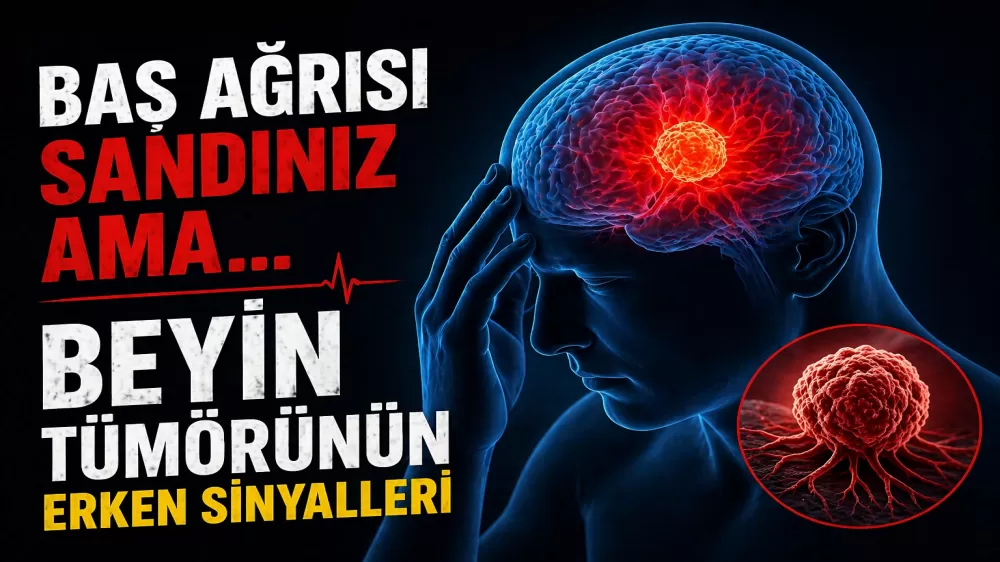 Baş Ağrısı Sandınız Ama… Beyin Tümörünün Erken Sinyalleri