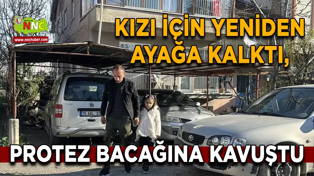 Kızı için yeniden ayağa kalktı, protez bacağına kavuştu