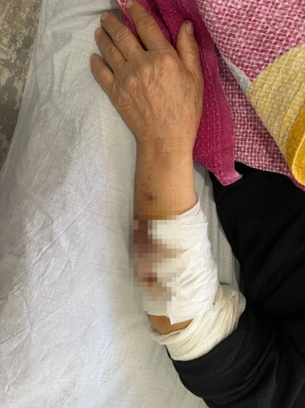 Ankara'da Yaşlı Kadına 8 Köpek Birden Saldırdı