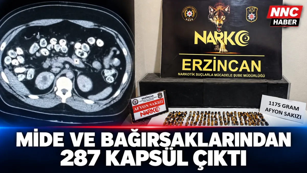Erzincan’da Mide ve Bağırsaklarından 287 Kapsül Uyuşturucu Çıktı 3 Tutuklama